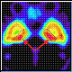 Bild: APA/PET SCAN/JOHANNES TAUSCHER