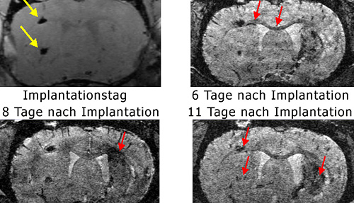 Bild: Max-Planck-Institut f¿r neurologische Forschung