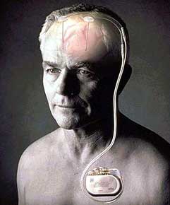 Bild: APA/MEDTRONIC