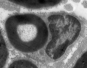 Bild: Max-Planck-Institut für experimentelle Medizin
