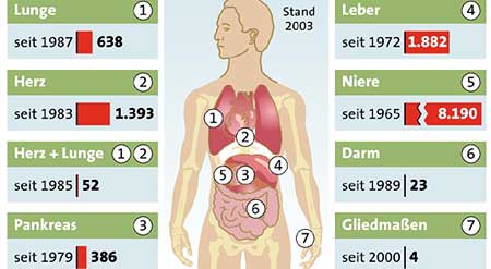 Grafik: © APA, Quelle: Eurotransplant/ÖBIG-Transplant