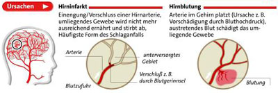 Grafik: APA