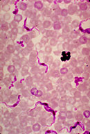 Bild: CDC/ Mae Melvin