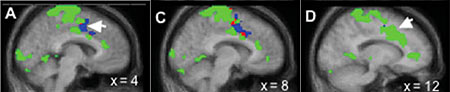 Bild: Michael J. Farrell et al./PNAS