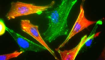 Bild: Sally Cross, MRC Human Genetics