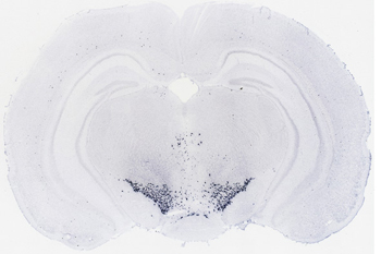 Bild: Allen Brain Atlas