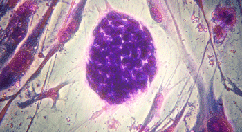 Bild: M. William Lensch, PhD. Harvard. Medical School