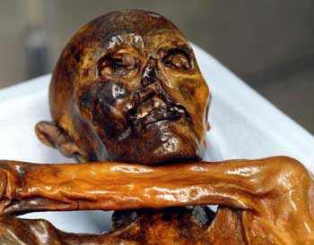 Bild: dpa/South Tyrol Museum of Archeology