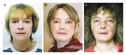 Bild: NEJM