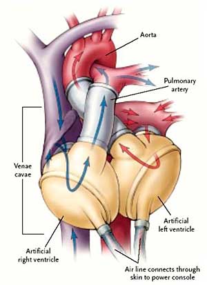 Bild: APA/Universit¿tsklinik f¿r Herzchirurgie Innsbruck