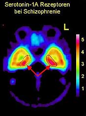 Bild: APA/PET SCAN/JOHANNES TAUSCHER